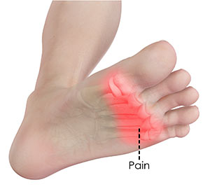 Forefoot Pain